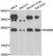 Ras-related protein Rab-5B antibody, LS-C349145, Lifespan Biosciences, Western Blot image 
