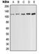 Protein Kinase D1 antibody, GTX32245, GeneTex, Western Blot image 