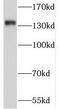 Sortilin Related VPS10 Domain Containing Receptor 2 antibody, FNab08115, FineTest, Western Blot image 