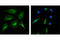 Poly(ADP-Ribose) Polymerase 1 antibody, 6987S, Cell Signaling Technology, Immunocytochemistry image 