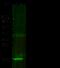 Protein S100-A7 antibody, GTX02302, GeneTex, Western Blot image 