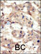 EPHB6 antibody, 63-064, ProSci, Immunohistochemistry paraffin image 