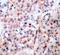 BCL2 antibody, TA333170, Origene, Immunohistochemistry paraffin image 