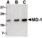 Lymphocyte Antigen 86 antibody, LS-C19608, Lifespan Biosciences, Western Blot image 