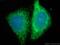 Pyruvate Dehydrogenase E1 Alpha 1 Subunit antibody, 18068-1-AP, Proteintech Group, Immunofluorescence image 