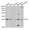 Retinol Binding Protein 4 antibody, TA332413, Origene, Western Blot image 