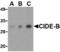 Cell Death Inducing DFFA Like Effector B antibody, MBS150739, MyBioSource, Western Blot image 