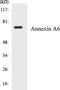 Annexin A6 antibody, EKC1030, Boster Biological Technology, Western Blot image 