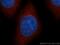 NAD(P)H Quinone Dehydrogenase 1 antibody, 11451-1-AP, Proteintech Group, Immunofluorescence image 