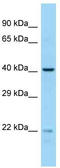 Probable crossover junction endonuclease EME2 antibody, TA339219, Origene, Western Blot image 