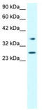 Forkhead Box A3 antibody, TA329710, Origene, Western Blot image 