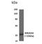 Killer cell immunoglobulin-like receptor 2DS4 antibody, NBP2-11762, Novus Biologicals, Western Blot image 