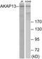 A-Kinase Anchoring Protein 13 antibody, EKC1785, Boster Biological Technology, Western Blot image 
