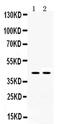 Hydroxysteroid 11-Beta Dehydrogenase 2 antibody, PA5-79399, Invitrogen Antibodies, Western Blot image 