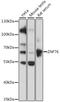 Zinc Finger Protein 76 antibody, 16-686, ProSci, Western Blot image 