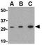 Aph-1 Homolog A, Gamma-Secretase Subunit antibody, GTX85062, GeneTex, Western Blot image 