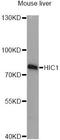 HIC ZBTB Transcriptional Repressor 1 antibody, LS-C748927, Lifespan Biosciences, Western Blot image 