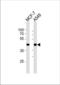 Cyclin-dependent kinase 20 antibody, TA324947, Origene, Western Blot image 