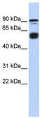 CTIP1 antibody, TA345234, Origene, Western Blot image 