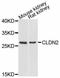 Claudin 2 antibody, A11843, ABclonal Technology, Western Blot image 