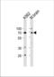 Tumor Protein P73 antibody, TA325079, Origene, Western Blot image 