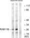RAB11B, Member RAS Oncogene Family antibody, LS-C199510, Lifespan Biosciences, Western Blot image 