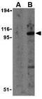 Toll Like Receptor 2 antibody, GTX31279, GeneTex, Western Blot image 