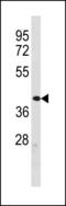 Zinc Finger Protein 92 antibody, LS-C203864, Lifespan Biosciences, Western Blot image 