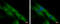 Calcium-binding mitochondrial carrier protein SCaMC-3 antibody, GTX116402, GeneTex, Immunocytochemistry image 