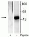 ETS domain-containing protein Elk-1 antibody, P01426, Boster Biological Technology, Western Blot image 