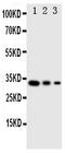 Thyroid Stimulating Hormone Receptor antibody, PA2013, Boster Biological Technology, Western Blot image 