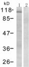 Protein Tyrosine Kinase 2 Beta antibody, TA321623, Origene, Western Blot image 