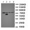 Solute carrier family 2, facilitated glucose transporter member 12 antibody, orb137938, Biorbyt, Western Blot image 