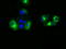 Nucleotide exchange factor SIL1 antibody, TA501043, Origene, Immunofluorescence image 