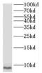 Small Nuclear Ribonucleoprotein Polypeptide G antibody, FNab08078, FineTest, Western Blot image 