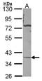 Carbonic anhydrase-related protein 11 antibody, LS-C186358, Lifespan Biosciences, Western Blot image 