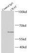 Carnitine O-Acetyltransferase antibody, FNab01952, FineTest, Immunoprecipitation image 