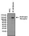 Androgen Receptor antibody, MA5-13423, Invitrogen Antibodies, Immunoprecipitation image 