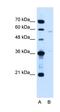 Coiled-Coil Domain Containing 112 antibody, orb325192, Biorbyt, Western Blot image 