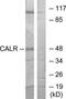 Calreticulin antibody, TA312147, Origene, Western Blot image 