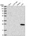 Abhydrolase Domain Containing 14A antibody, HPA038153, Atlas Antibodies, Western Blot image 