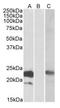 Cystatin-8 antibody, AP21268PU-N, Origene, Western Blot image 