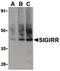 Single Ig And TIR Domain Containing antibody, PA5-20078, Invitrogen Antibodies, Western Blot image 
