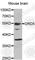 Dopamine Receptor D5 antibody, A1719, ABclonal Technology, Western Blot image 