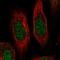 Ribosomal Protein S19 antibody, HPA063217, Atlas Antibodies, Immunocytochemistry image 