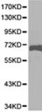 Tamm-Horsfall urinary glycoprotein antibody, TA323471, Origene, Western Blot image 