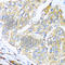 Mesencephalic Astrocyte Derived Neurotrophic Factor antibody, A7005, ABclonal Technology, Immunohistochemistry paraffin image 