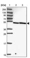 ZFP3 Zinc Finger Protein antibody, PA5-62726, Invitrogen Antibodies, Western Blot image 