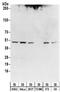 Isocitrate dehydrogenase [NAD] subunit gamma 1, mitochondrial antibody, NBP2-32150, Novus Biologicals, Western Blot image 