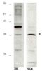 HUS1 Checkpoint Clamp Component B antibody, orb345458, Biorbyt, Western Blot image 